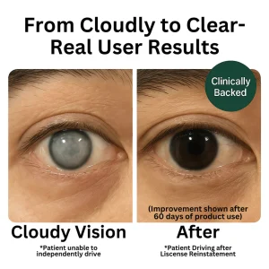 ZOONE Eye Vitamin and Mineral Supplement