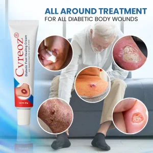 Cvreoz® Diabetic Foot Healing Cream