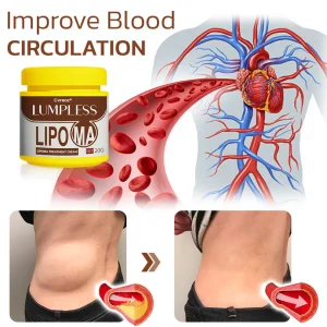 Cvreoz® Lumpless Lipoma Treatment Cream