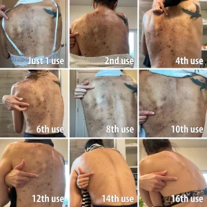 Melanin Correcting Brightening Serum