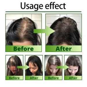 Cvreoz Nourish & Flourish Hair Growth Spray