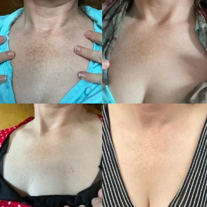 Melanin Correcting Brightening Serum