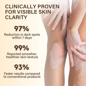 YUNPSO® VitiHeali Yellowjacket Neurotoxic fluid Extractm Cream Ultra