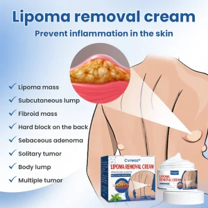 Cvreoz® Lipoma Removal Cream