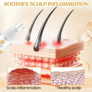 Cvreoz® Ginger Hair Regrowth Serum