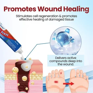 Cvreoz® Diabetic Foot Ulcer Repair Cream