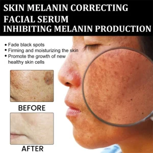Melanin Correcting Brightening Serum