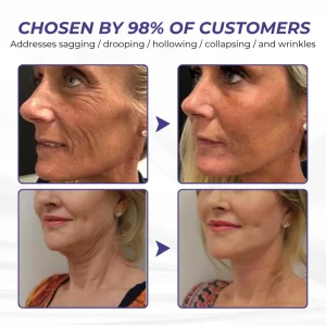 Timilk® ElastaPro Emu Oil Skin Firming Cream