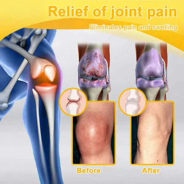 ADFIRE® Bee Venom Pain-Relief Bone Healing Spray