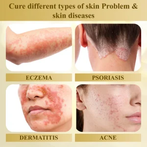 Fivfivgo® Condense Mellifera Venom Skin Repairing Cream