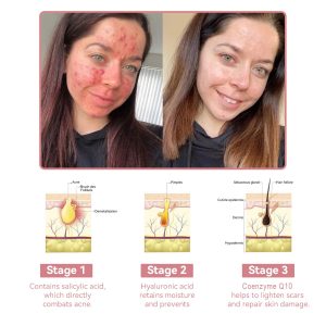 Awzlove™ Coenzyme Q10 Collagen Jelly Skin Cream