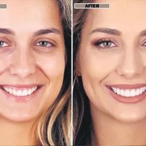 NESLEMY™Coconut Whitening Strips