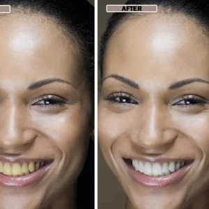 NESLEMY™Coconut Whitening Strips