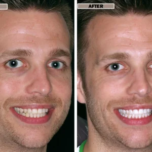 NESLEMY™Coconut Whitening Strips