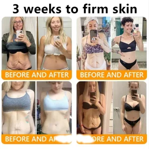 ADFIRE® Bee venom Comprehensive Cream