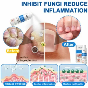 HZA™ Magnesium Herbal Psoriasis Spray