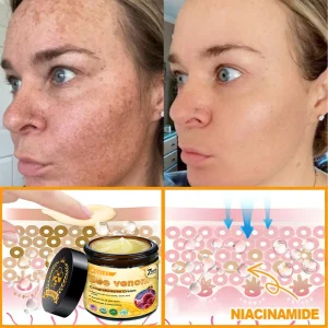 ADFIRE® Bee venom Comprehensive Cream