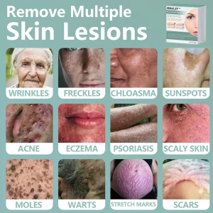 ODALIT™ MicroNeedle Botanic skin Tag Removal Patch