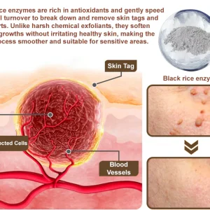 Zvoevo® Black Rice Skin Repair Essence Cream