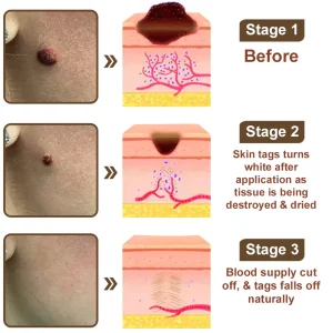 Zvoevo® Black Rice Skin Repair Essence Cream