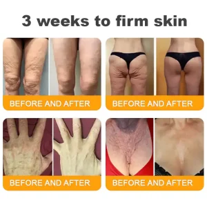 TAILEDEN® Bee Venom Skin Restoration Cream