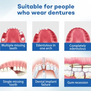Nurbini® ThermoSeal Fresh Denture