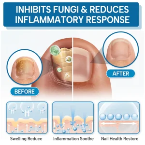 Lyyeto® OnyxiGuard Fungal Repair Herbal Spray ACE