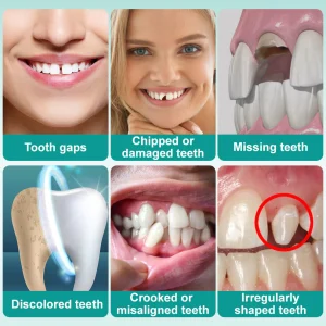 Ourlyard® Instant Stick on Dental Veneers