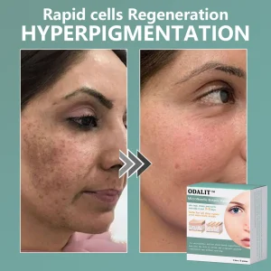 ODALIT™ MicroNeedle Botanic skin Tag Removal Patch