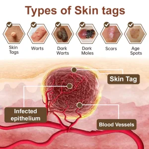 Zvoevo® Black Rice Skin Repair Essence Cream