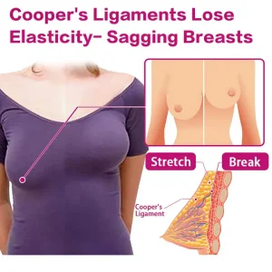 BQYOOM™ 100% Natural Sagging Repair Patch