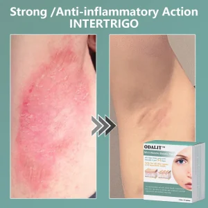 ODALIT™ MicroNeedle Botanic skin Tag Removal Patch