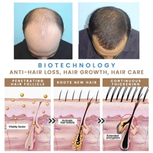 Put an end to hair loss with LOVILDS™ Rollerball Serum