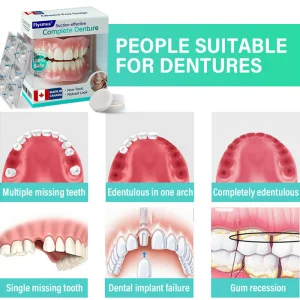 Flysmus® Suction-fit Complete Denture