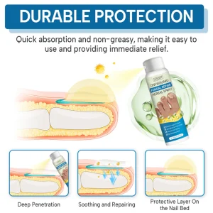 Lyyeto® OnyxiGuard Fungal Repair Herbal Spray ACE