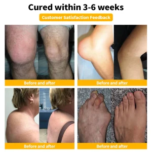 LOVILDS™ Bee Venom Joint Repair Cream