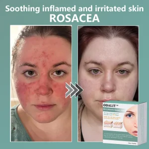 ODALIT™ MicroNeedle Botanic skin Tag Removal Patch