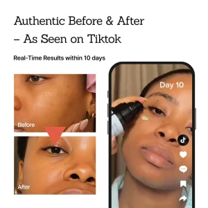 NESLEMY™Retinal Skin Booster Serum