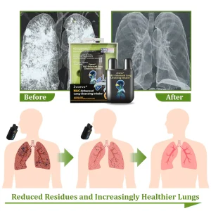 Zvoevo® NAC-Enhanced Lung Cleansing Inhaler