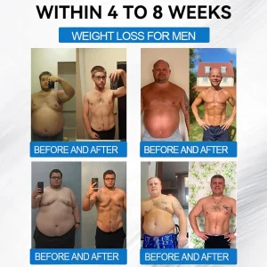 ADFIRE® SMGT-GLP-1 Tirzepatide & Collagen Nano Microneedle Weight Loss Patch