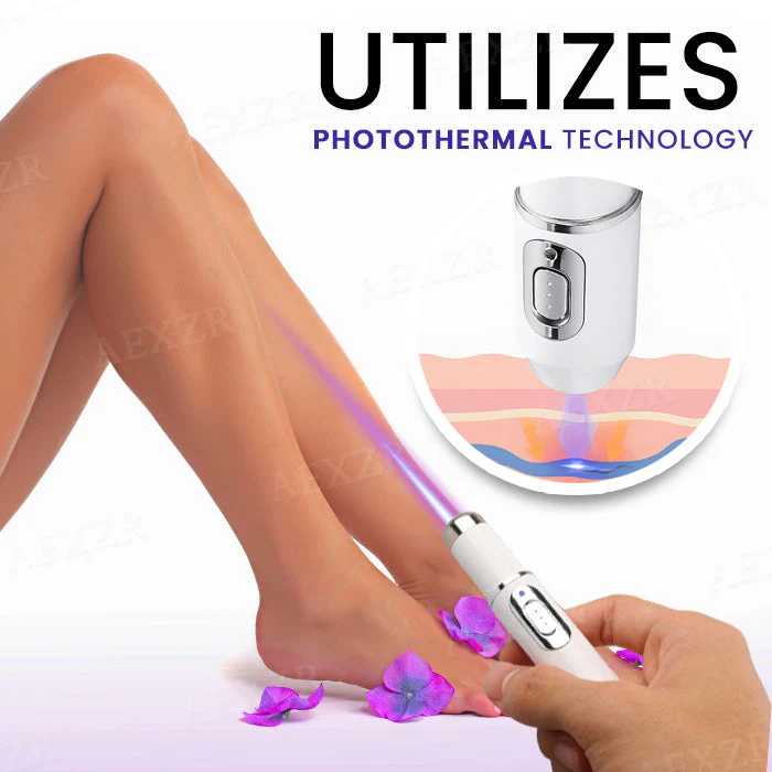 Bikenda® Varicose Vein Photothermal Laser Treatment 3 Bikenda® Varicose Vein Photothermal Laser Treatment