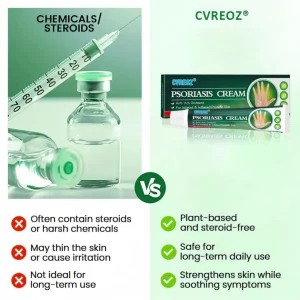 Cvreoz® Knotaway Psoriasis Cream
