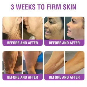 YUNPSO™ Queen Nectar Peptide + Bakuchiol Skin Restoration Cream