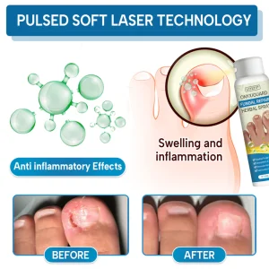 Lyyeto® OnyxiGuard Fungal Repair Herbal Spray ACE