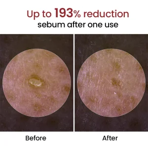 Biancat® Peel Shot Glow Black Rice Ampoule