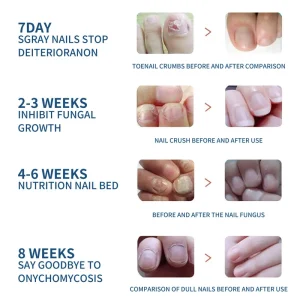 Health Care Patches – Repair and Strengthen Weak Nails