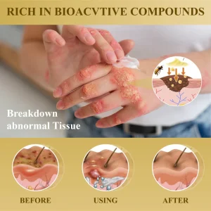 Fivfivgo® Condense Mellifera Venom Skin Repairing Cream