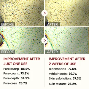 Biancat® Peel Shot Glow Black Rice Ampoule