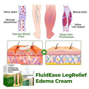 Timilk® FluidEase Leg Relief Edema Cream