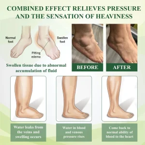 ATTDX® FlowBoost Edema Drain Herbal Roll On